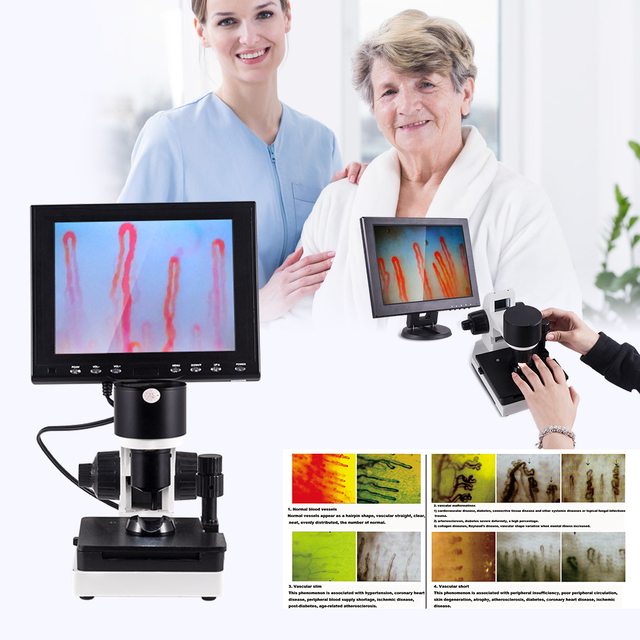 LCD Display Colour Microcirculation Test Machine Clinical Hospital Home