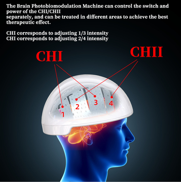 Rtms Therapy Brain Helmet Transcranial Magnetic Stimulator Photobiomodulation